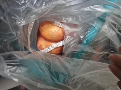 구매후기 사진